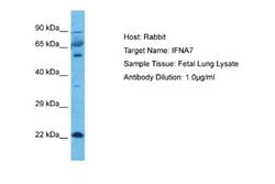IFN-alpha J1/IFNA7 Rabbit anti-Human, Polyclonal, Novus Biologicals 0.1 mL | Buy Online | Novus Biologicals | Fisher Scientific